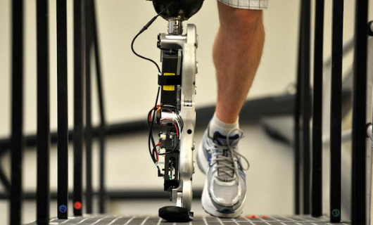 患者安裝河南假肢時需要注意事項,如何區分假肢(圖1) 患者安裝河南假肢時需要注意事項,如何區分假肢(圖1)