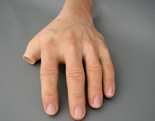 安裝一個(gè)左手假肢價(jià)格多少錢(圖1) 安裝一個(gè)左手假肢價(jià)格多少錢(圖1)