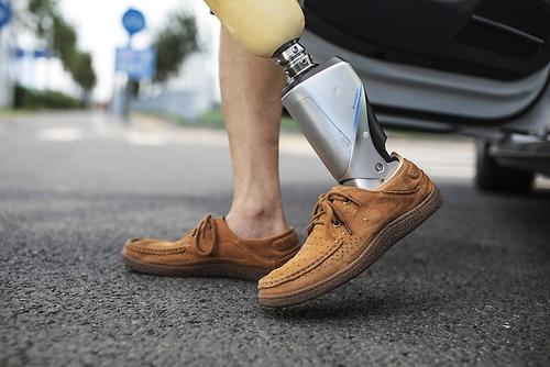 安裝一個(gè)假肢大概需要多少錢鄭州力康假肢廠家(圖1) 安裝一個(gè)假肢大概需要多少錢鄭州力康假肢廠家(圖1)