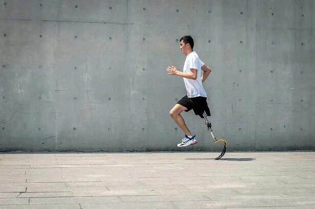 假肢廠家講解截肢者如何保護好自己的假肢不受損害?(圖1) 假肢廠家